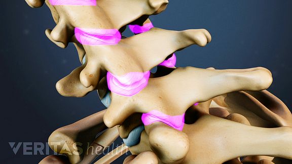 Cervical Facet Joint
