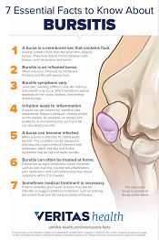 7 Essential Facts to Know AboutBursitis