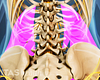 Posterior view of the muscles of the low back that can cause spasms.