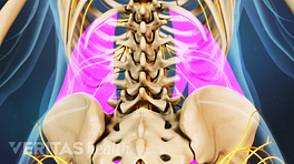 Posterior view of the lower back showing muscles of the lumbar spine.