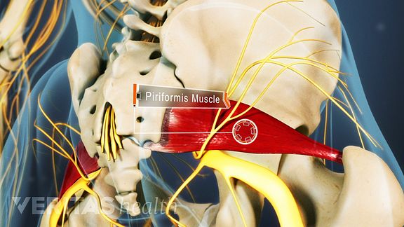 Anatomy of the Sciatic Nerve