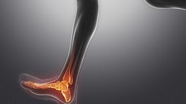 View of the leg showing pain in the ankle joint.