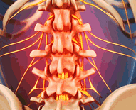 Back Pain, Neck Pain, Lower Back Pain | Spine-Health