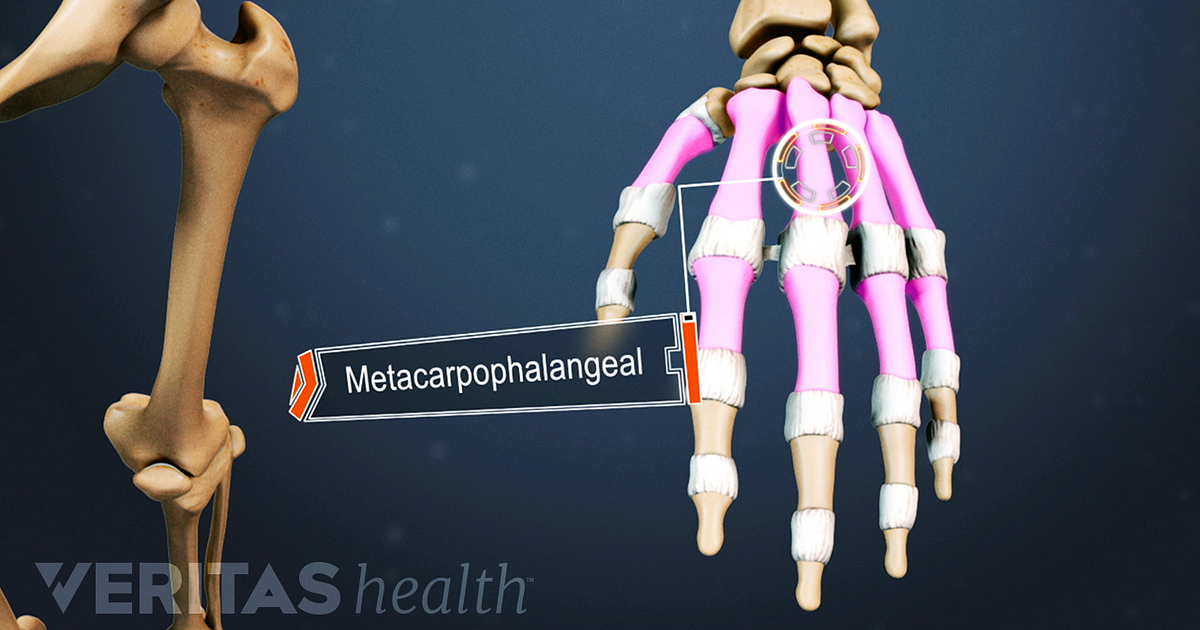 Mcp Joint Anatomy