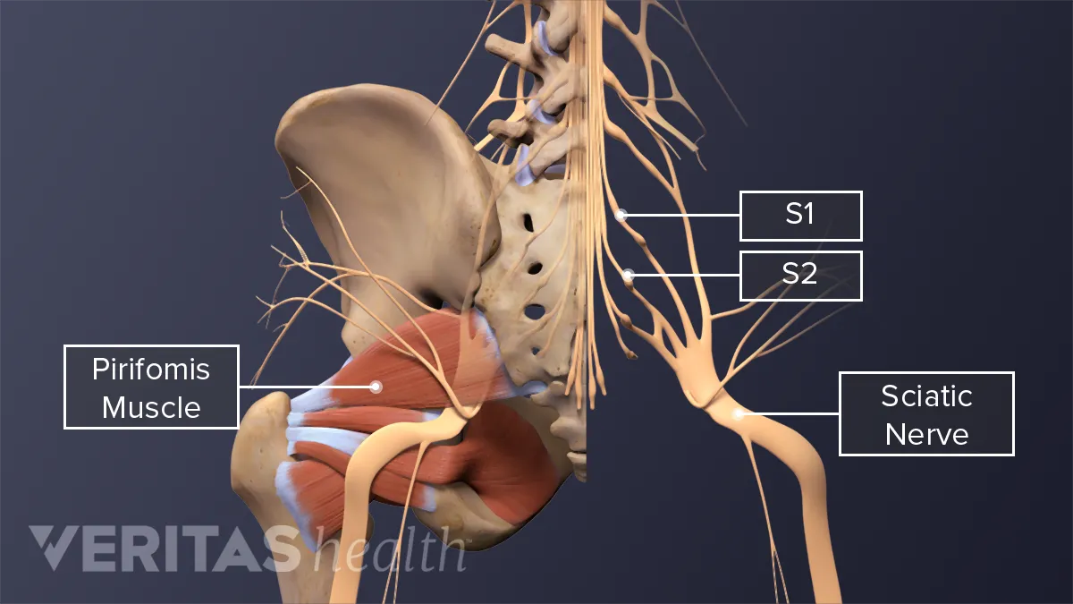 Understanding The Origin of Piriformis Syndrome and Sitting