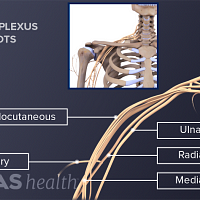 Illustration of the nerve roots of the brachial plecus
