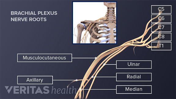 Medical illustration of the nerve roots that make up the brachial plexus