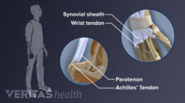 balsam articular ligamentar