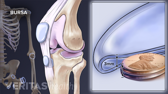 illustration of bursa in the knee, comparing it to the size of 2 pennies stacked on top of each other, or 3mm.
