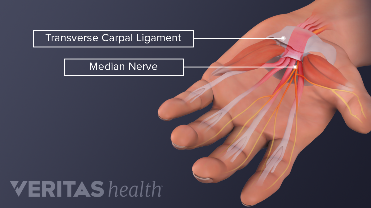 Is My Hand Pain From Carpal Tunnel Syndrome Or Something Else