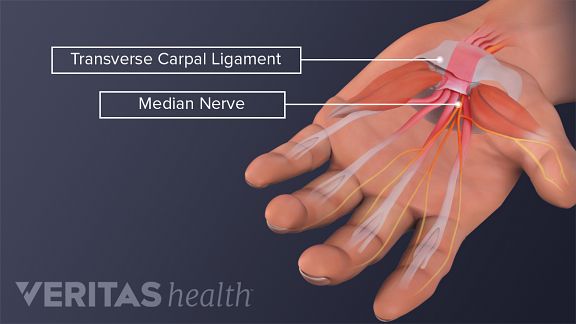 Carpal Tunnel Surgery >> Carpal Tunnel Surgery What To Expect Carpal Tunnel Surgery >> Carpal Tunnel Surgery What To Expect