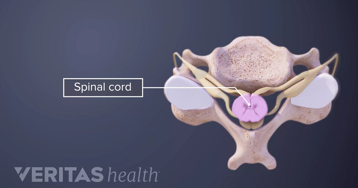 Cordotomy Definition | Back Pain and Neck Pain Medical Glossary