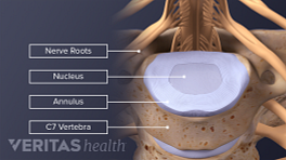 C6-C7 vertebral segment labeling nerve roots, nucleus, annulus, cervical vertebra.
