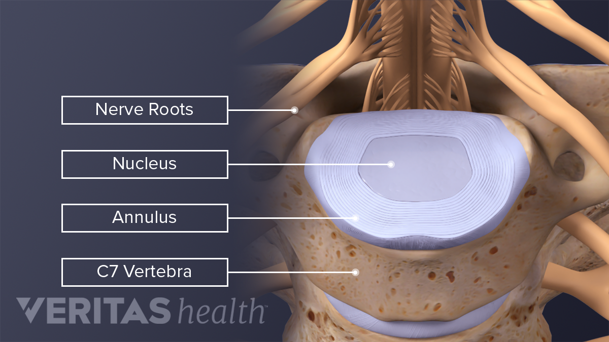 Back Pain, Neck Pain, Lower Back Pain | Spine-health