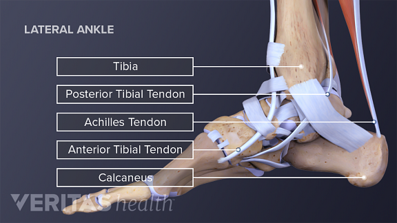 All About Ankle Sprains And Strains