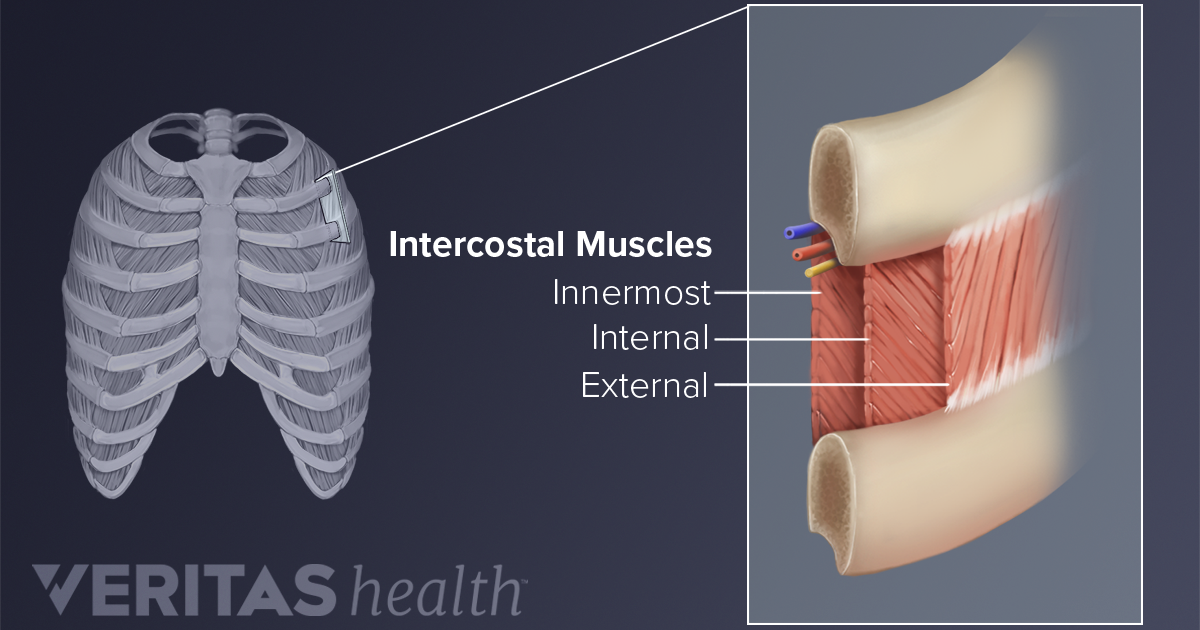 Upper Back Pain From Intercostal Muscle Strain