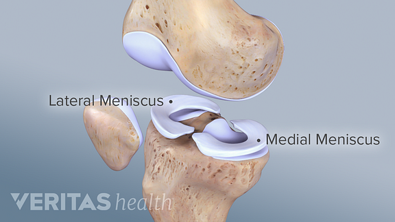 View of the lateral and medial menisci