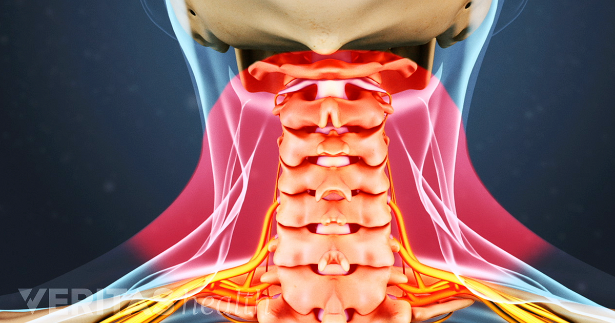 common-causes-of-neck-pain