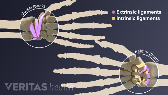 Palmar and dorsal view of the hand labeling intrinsic and extrinsic wrist ligaments