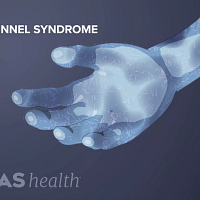 Palmar view of the hand showing numbness caused by carpal tunnel syndrome.