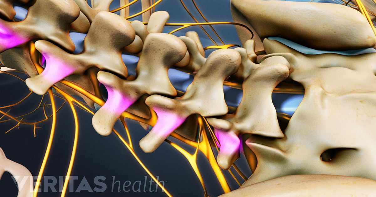 External Bone Growth Stimulators For Spine Fusion 