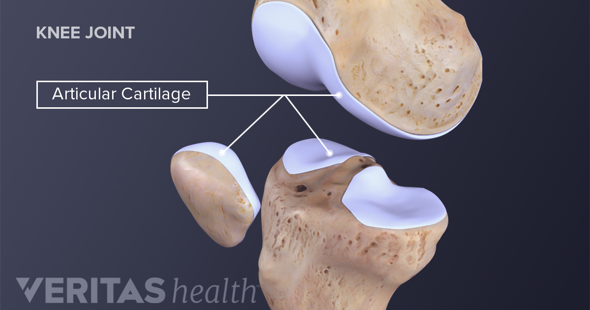 articular cartilage la mersul durerii în genunchi