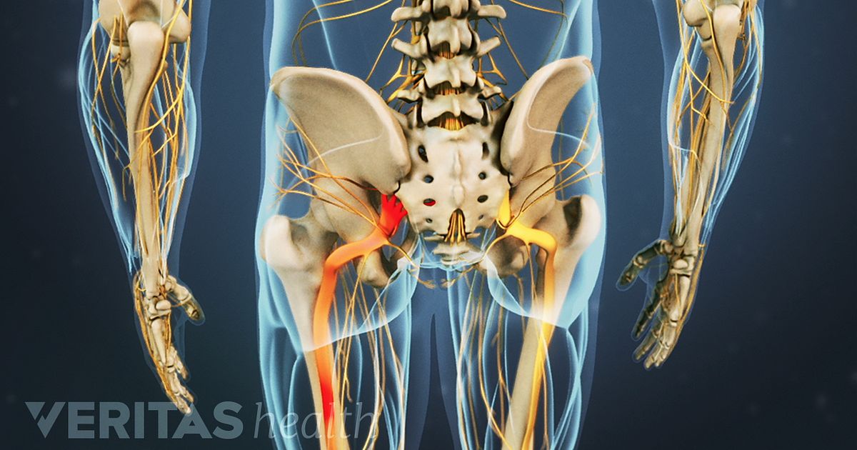 Back Pain: A Guide for Understanding Back Pain