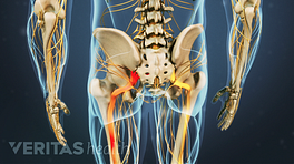 Posterior view of pelvis with pain going down the left leg.