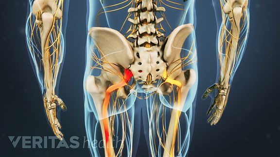 Sciatica Nerve Stretches, Protocols, and Treatments for Faster Pain Relief