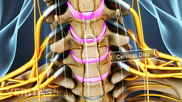 Anterior view of the cervical spine labeling cervical discs.