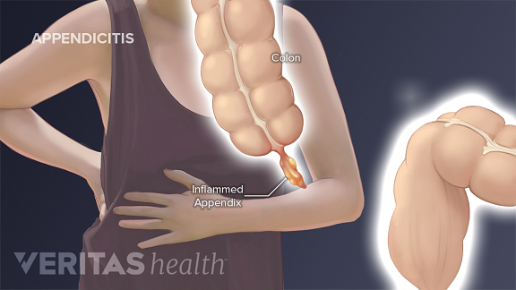 What causes pain on the right side of the stomach What Pain On Your Right Side Could Mean