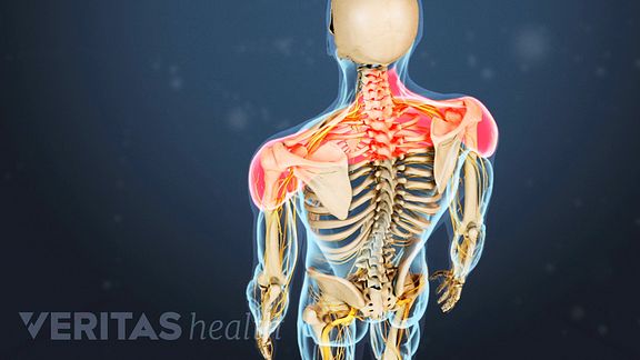 Cervical Facet Osteoarthritis