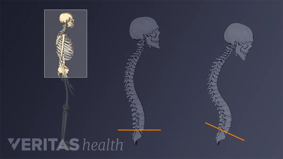The Spine's Role in Posture and Performance