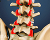 Posterior view of the lower back highlighting facet joints in the lumbar spine.