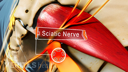 Close up illustration of the piriformis muscle and sciatic nerve. The sciatic nerve is labeled.