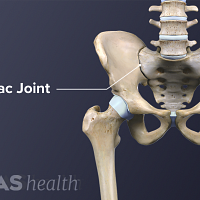 Axial Spondyloarthritis Definition | Defined by Arthritis-Health