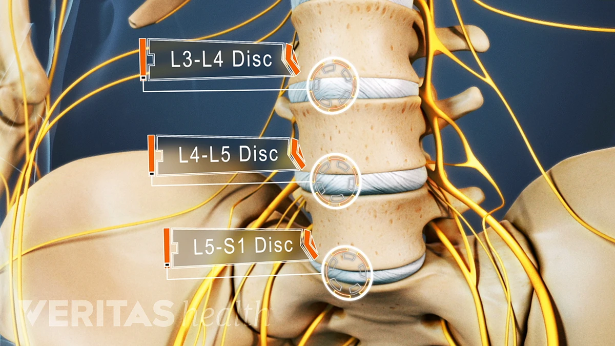 All About the L3-L4 Spinal Segment | Spine-health