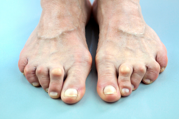 RA Feet