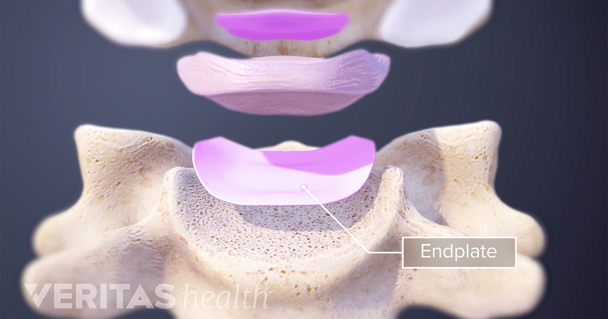 Vertebral End Plates Definition | Back Pain and Neck Pain Medical Glossary