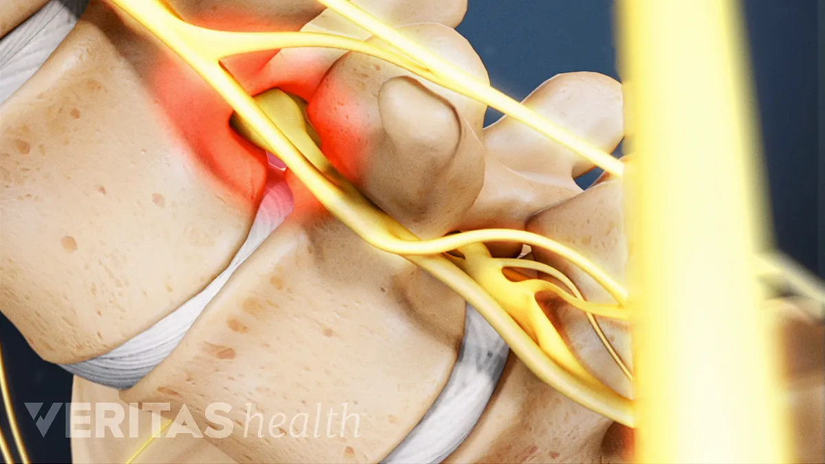 The Myths of Back Pain  South Coast Medical Group