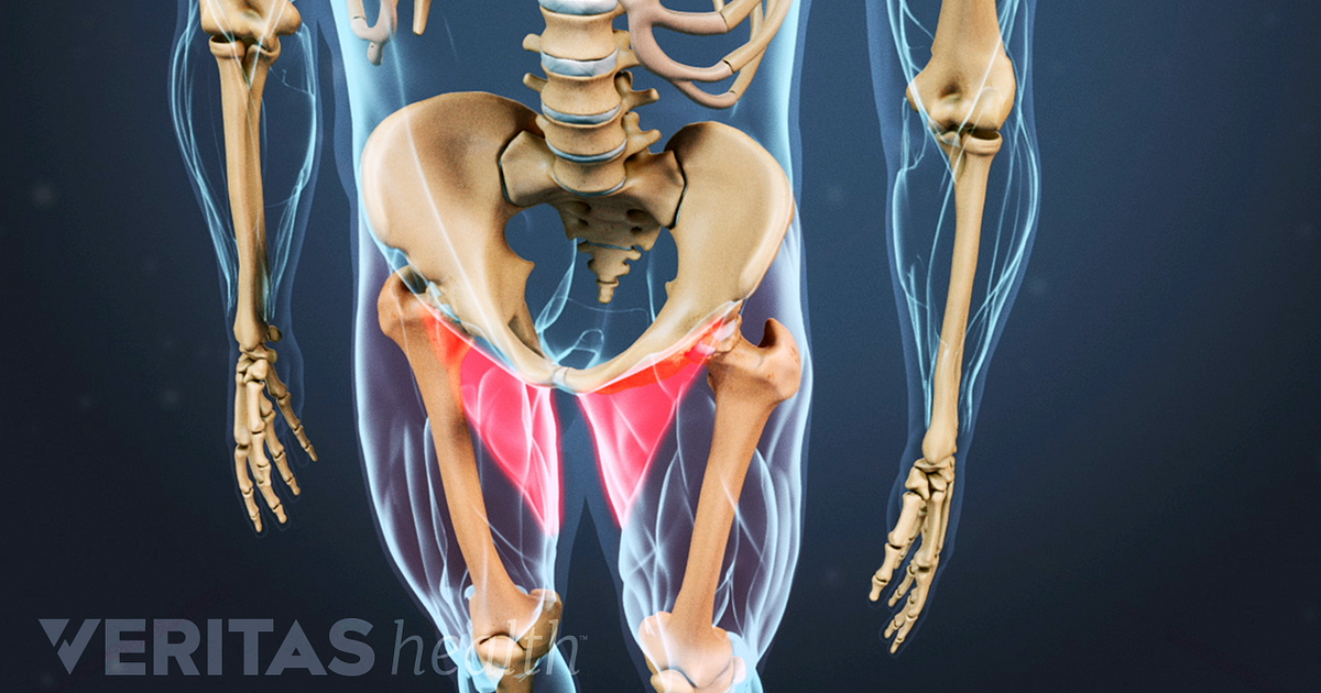 What Is A Torn Groin What Is A Torn Groin