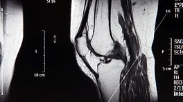Profile view of an MRI Knee Scan