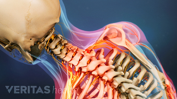 Neck Pain Symptoms