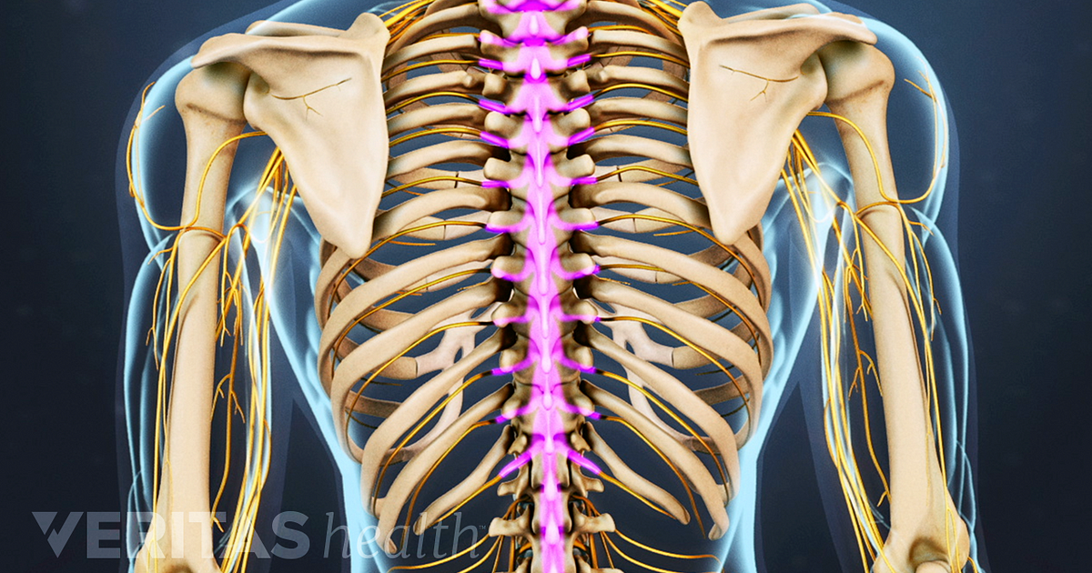 causes of failed back surgery syndrome