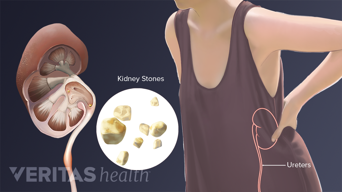 Abdominal Anatomy Female Right Side : Anterior Abdominal Wall Amboss