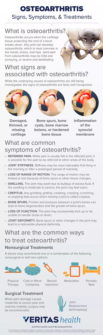osteoartrita vertebrală