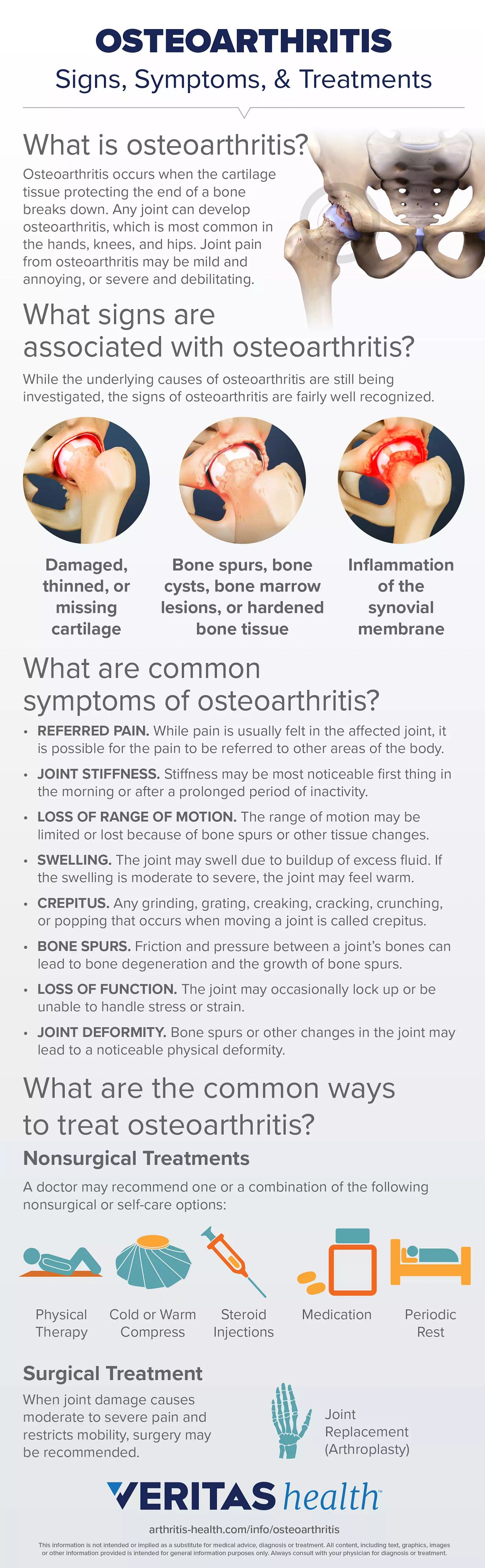 osteoarthritis symptoms and signs)