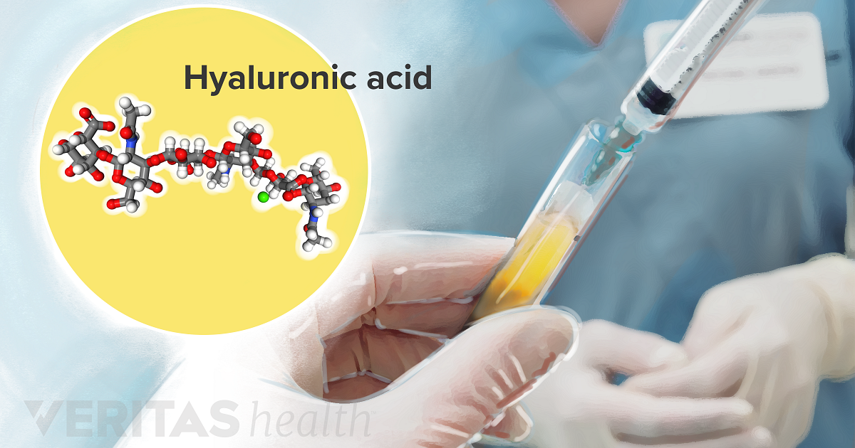  Hyaluronic Acid Definition Defined by Arthritis-Health