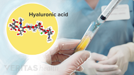 Medical illustration showing compound of Hyaluronic Acid.