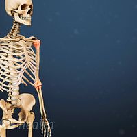 Anterior view of a skeleton highlighting rheumatoid arthritis in symmetrical joints.